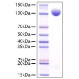 SDS-PAGE - Recombinant Mouse c-Kit Protein (C-terminal Rabbit Fc Tag) (A331523) - Antibodies.com