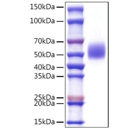 SDS-PAGE - Recombinant Mouse c-Kit Protein (C-terminal His Tag) (A331524) - Antibodies.com