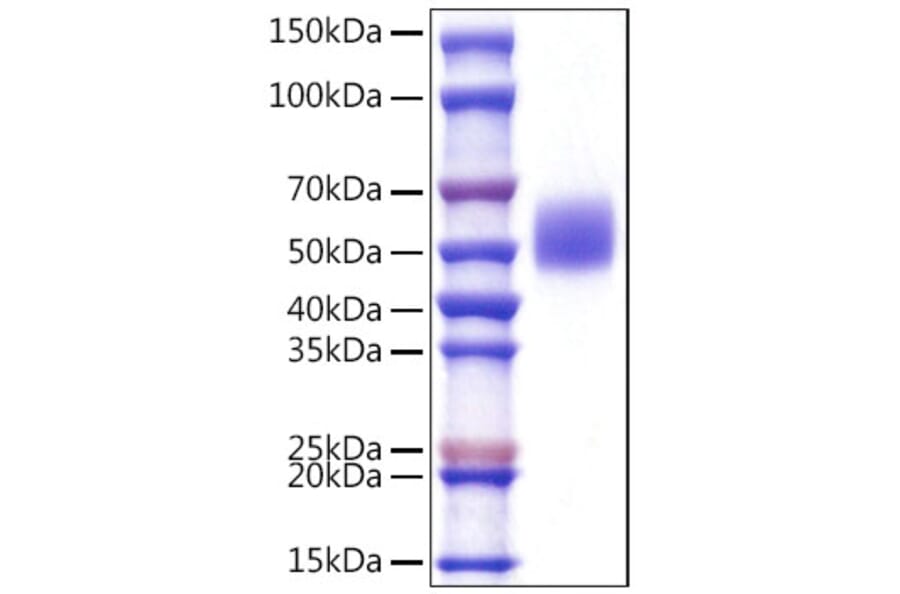 SDS-PAGE - Recombinant Mouse c-Kit Protein (C-terminal His Tag) (A331524) - Antibodies.com