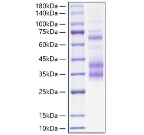 SDS-PAGE - Recombinant Mouse Clusterin Protein (C-terminal His Tag) (A331525) - Antibodies.com