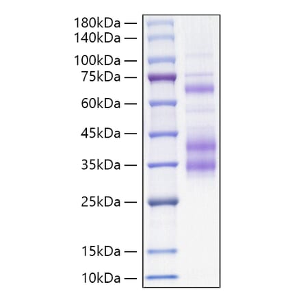 SDS-PAGE - Recombinant Mouse Clusterin Protein (C-terminal His Tag) (A331525) - Antibodies.com