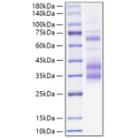 SDS-PAGE - Recombinant Mouse Clusterin Protein (C-terminal His Tag) (A331525) - Antibodies.com