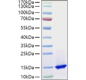 SDS-PAGE - Recombinant Mouse C3 Protein (C-terminal His and Avi Tag) (A331526) - Antibodies.com