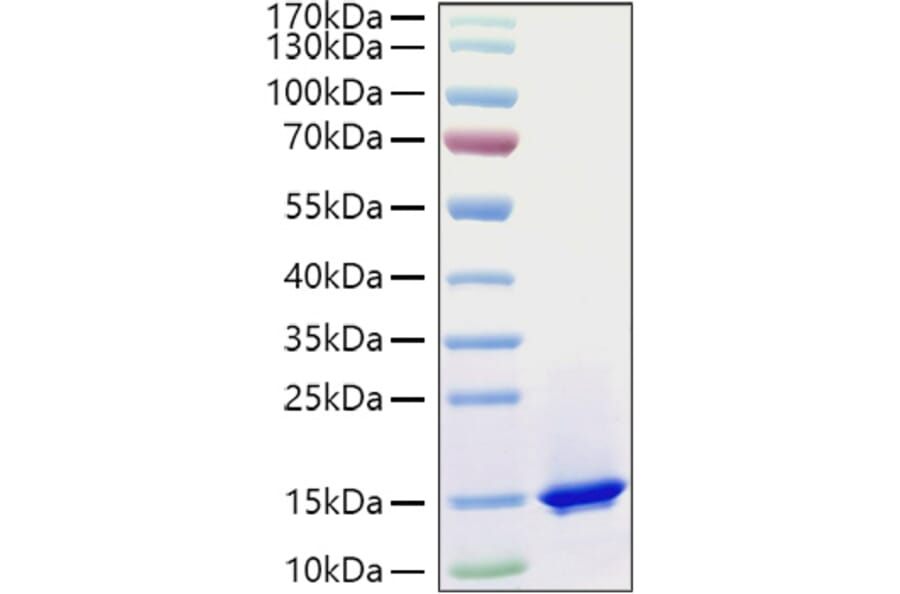 SDS-PAGE - Recombinant Mouse C3 Protein (C-terminal His and Avi Tag) (A331526) - Antibodies.com