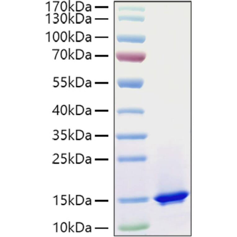 SDS-PAGE - Recombinant Mouse C3 Protein (C-terminal His and Avi Tag) (A331526) - Antibodies.com