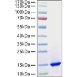 SDS-PAGE - Recombinant Mouse C3 Protein (C-terminal His and Avi Tag) (A331526) - Antibodies.com