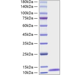 SDS-PAGE - Recombinant Mouse C5 Protein (A331527) - Antibodies.com