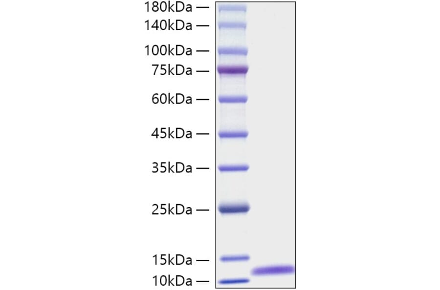 SDS-PAGE - Recombinant Mouse C5 Protein (A331527) - Antibodies.com