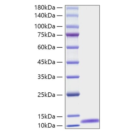 SDS-PAGE - Recombinant Mouse C5 Protein (A331527) - Antibodies.com