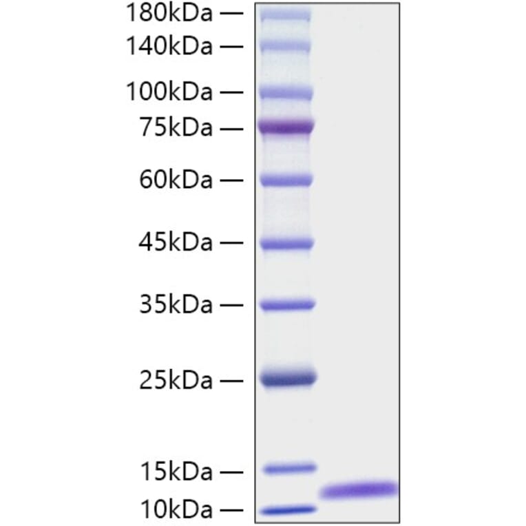 SDS-PAGE - Recombinant Mouse C5 Protein (A331527) - Antibodies.com