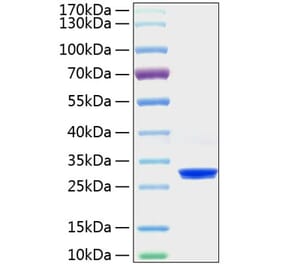 SDS-PAGE - Recombinant Mouse C Reactive Protein Protein (C-terminal His Tag) (A331528) - Antibodies.com