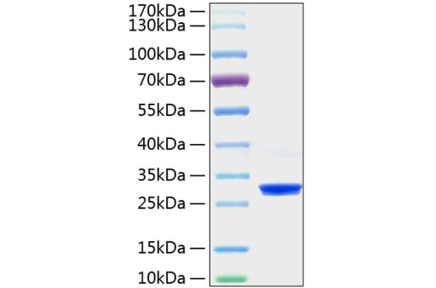 SDS-PAGE - Recombinant Mouse C Reactive Protein Protein (C-terminal His Tag) (A331528) - Antibodies.com