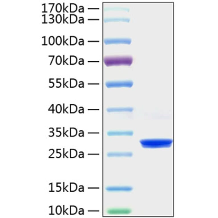 SDS-PAGE - Recombinant Mouse C Reactive Protein Protein (C-terminal His Tag) (A331528) - Antibodies.com