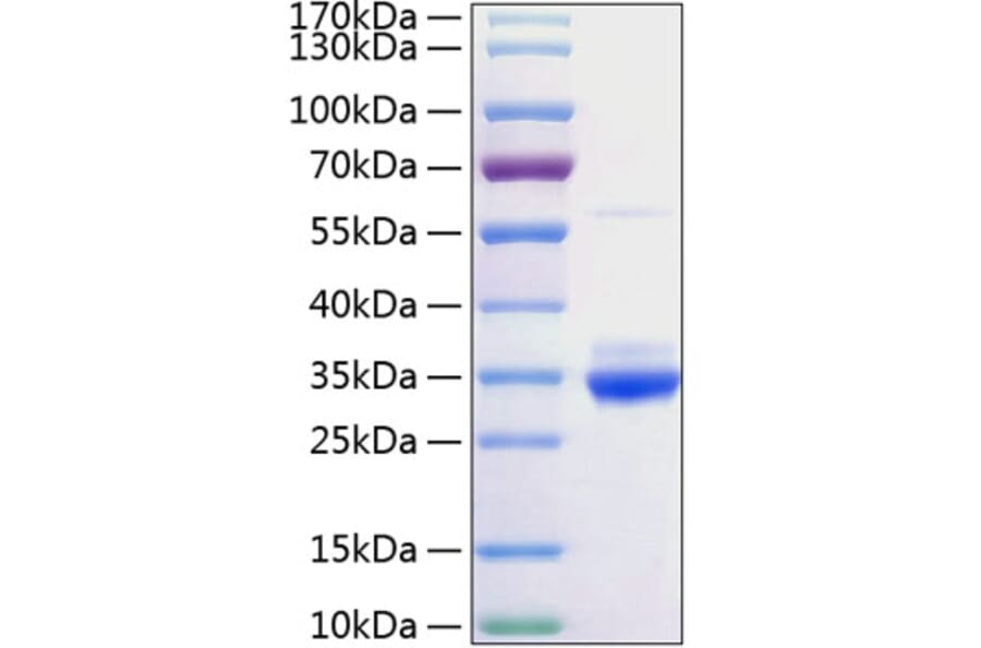 SDS-PAGE - Recombinant Rat C Reactive Protein Protein (C-terminal His Tag) (A331529) - Antibodies.com