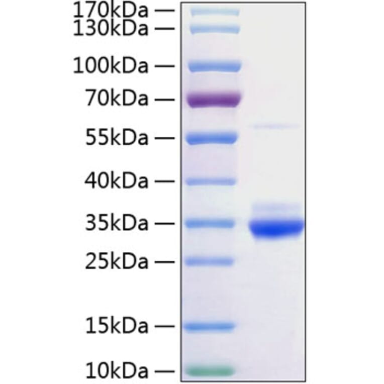 SDS-PAGE - Recombinant Rat C Reactive Protein Protein (C-terminal His Tag) (A331529) - Antibodies.com