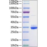 SDS-PAGE - Recombinant Rat C Reactive Protein Protein (C-terminal His Tag) (A331529) - Antibodies.com