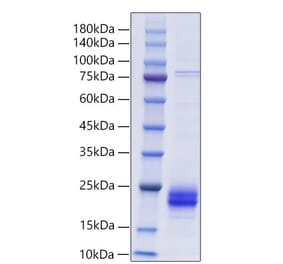 SDS-PAGE - Recombinant Mouse Cripto Protein (C-terminal His Tag) (A331530) - Antibodies.com