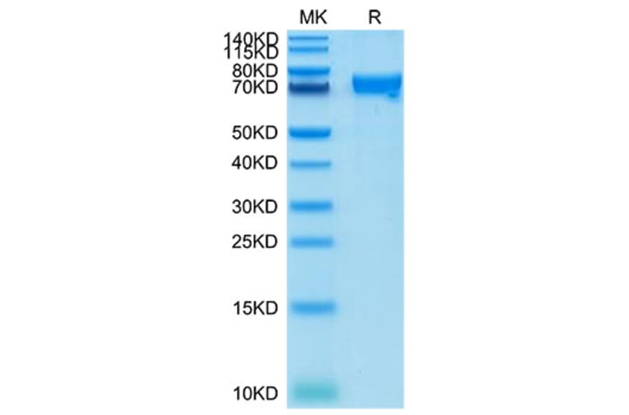 Tris-Bis PAGE - Recombinant Cynomolgus macaque CRTAM Protein (C-terminal Human Fc Tag) (A331531) - Antibodies.com