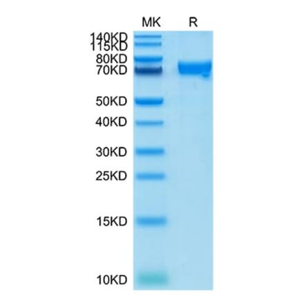 Tris-Bis PAGE - Recombinant Cynomolgus macaque CRTAM Protein (C-terminal Human Fc Tag) (A331531) - Antibodies.com