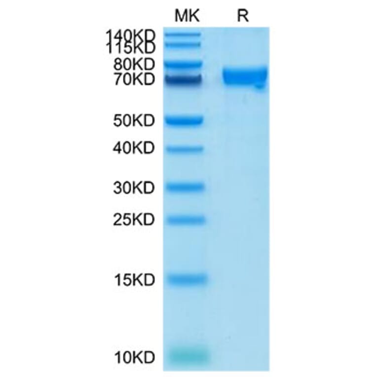 Tris-Bis PAGE - Recombinant Cynomolgus macaque CRTAM Protein (C-terminal Human Fc Tag) (A331531) - Antibodies.com