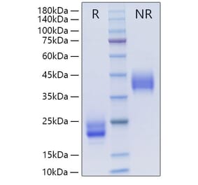 SDS-PAGE - Recombinant Mouse M-CSF Protein (A331532) - Antibodies.com