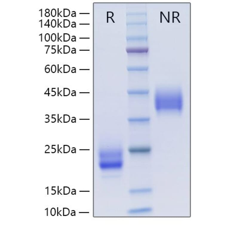SDS-PAGE - Recombinant Mouse M-CSF Protein (A331532) - Antibodies.com