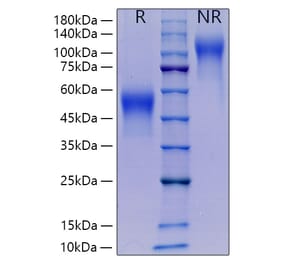 SDS-PAGE - Recombinant Mouse M-CSF Protein (C-terminal His Tag) (A331533) - Antibodies.com