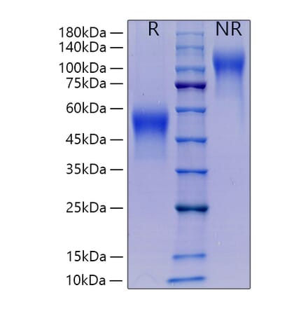 SDS-PAGE - Recombinant Mouse M-CSF Protein (C-terminal His Tag) (A331533) - Antibodies.com