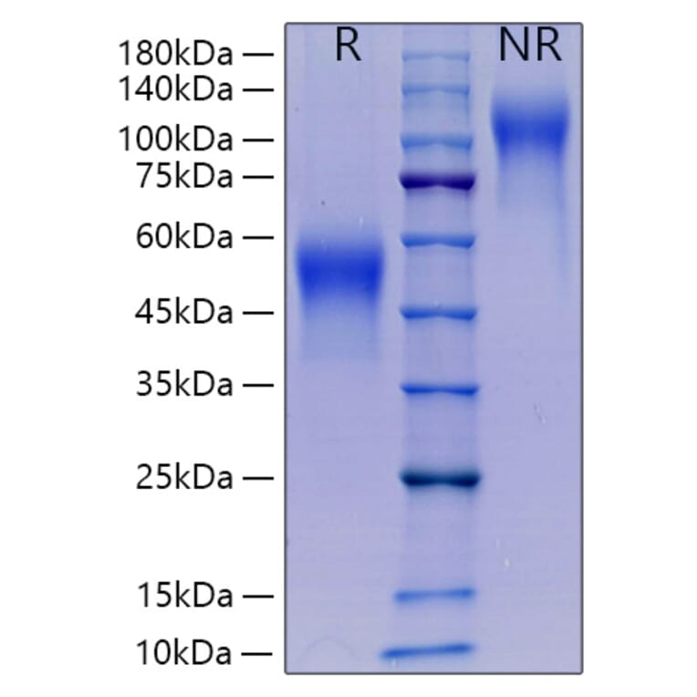 SDS-PAGE - Recombinant Mouse M-CSF Protein (C-terminal His Tag) (A331533) - Antibodies.com
