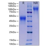 SDS-PAGE - Recombinant Mouse M-CSF Protein (C-terminal His Tag) (A331533) - Antibodies.com