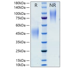 SDS-PAGE - Recombinant Rat M-CSF Protein (C-terminal His Tag) (A331534) - Antibodies.com