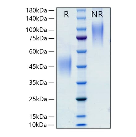 SDS-PAGE - Recombinant Rat M-CSF Protein (C-terminal His Tag) (A331534) - Antibodies.com