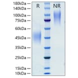 SDS-PAGE - Recombinant Rat M-CSF Protein (C-terminal His Tag) (A331534) - Antibodies.com