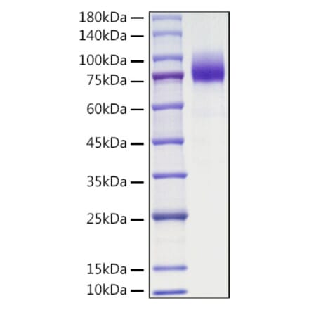 SDS-PAGE - Recombinant Mouse CSF-1-R Protein (C-terminal His Tag) (A331535) - Antibodies.com