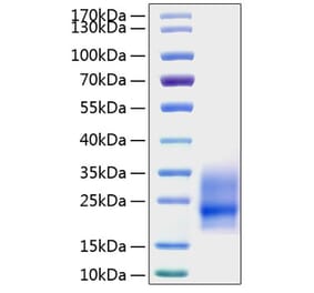 SDS-PAGE - Recombinant Mouse GM-CSF Protein (N-terminal His Tag) (A331536) - Antibodies.com