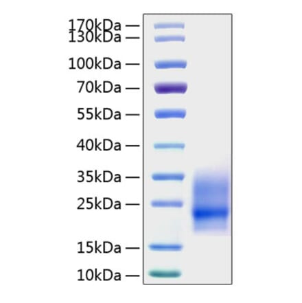 SDS-PAGE - Recombinant Mouse GM-CSF Protein (N-terminal His Tag) (A331536) - Antibodies.com