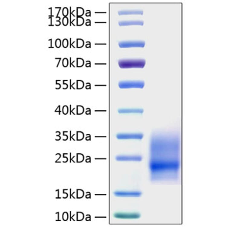 SDS-PAGE - Recombinant Mouse GM-CSF Protein (N-terminal His Tag) (A331536) - Antibodies.com