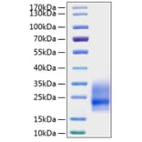 SDS-PAGE - Recombinant Mouse GM-CSF Protein (N-terminal His Tag) (A331536) - Antibodies.com