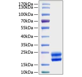 SDS-PAGE - Recombinant Rat GM-CSF Protein (N-terminal His Tag) (A331537) - Antibodies.com