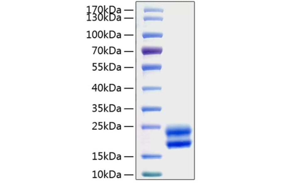 SDS-PAGE - Recombinant Rat GM-CSF Protein (N-terminal His Tag) (A331537) - Antibodies.com