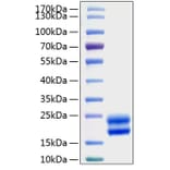 SDS-PAGE - Recombinant Rat GM-CSF Protein (N-terminal His Tag) (A331537) - Antibodies.com