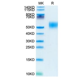 Tris-Bis PAGE - Recombinant Mouse CD116 Protein (C-terminal His Tag) (A331538) - Antibodies.com