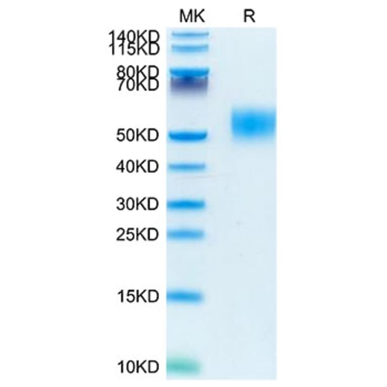 Tris-Bis PAGE - Recombinant Mouse CD116 Protein (C-terminal His Tag) (A331538) - Antibodies.com