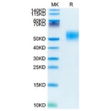 Tris-Bis PAGE - Recombinant Mouse CD116 Protein (C-terminal His Tag) (A331538) - Antibodies.com