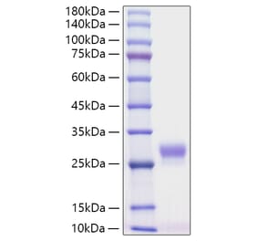 SDS-PAGE - Recombinant Mouse G-CSF Protein (C-terminal His Tag) (A331539) - Antibodies.com