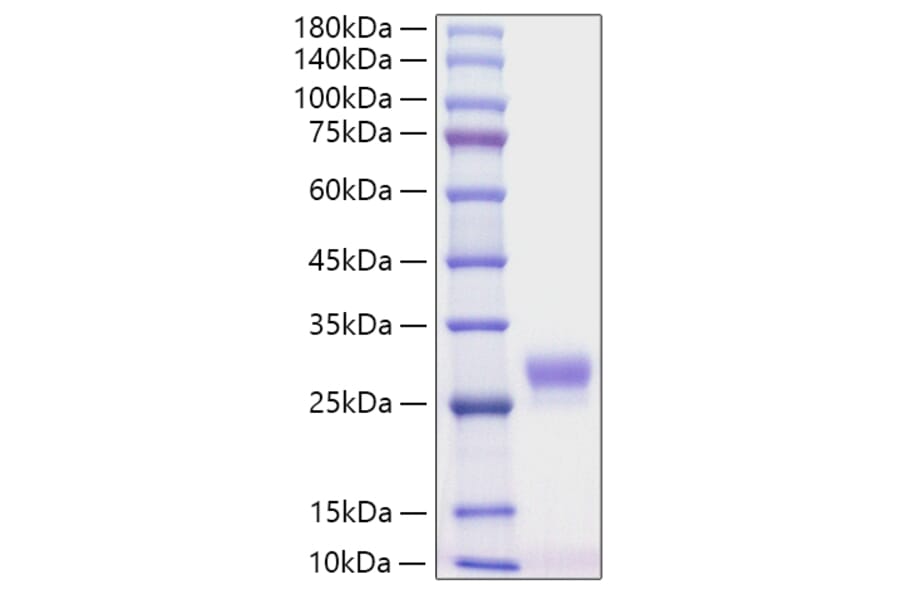 SDS-PAGE - Recombinant Mouse G-CSF Protein (C-terminal His Tag) (A331539) - Antibodies.com