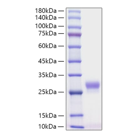 SDS-PAGE - Recombinant Mouse G-CSF Protein (C-terminal His Tag) (A331539) - Antibodies.com