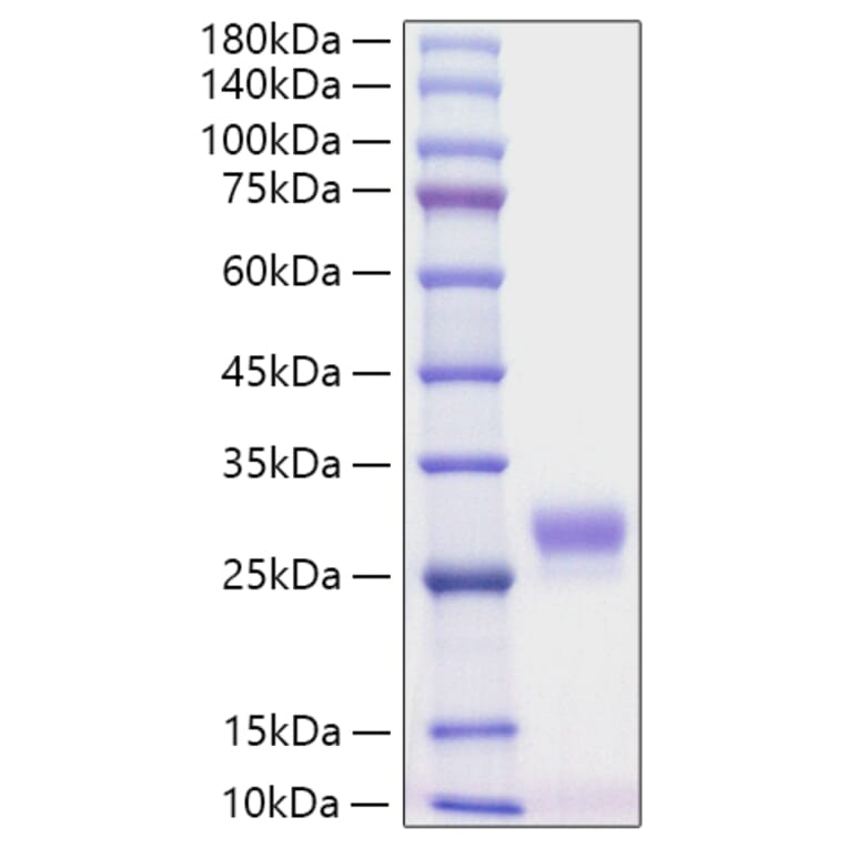 SDS-PAGE - Recombinant Mouse G-CSF Protein (C-terminal His Tag) (A331539) - Antibodies.com