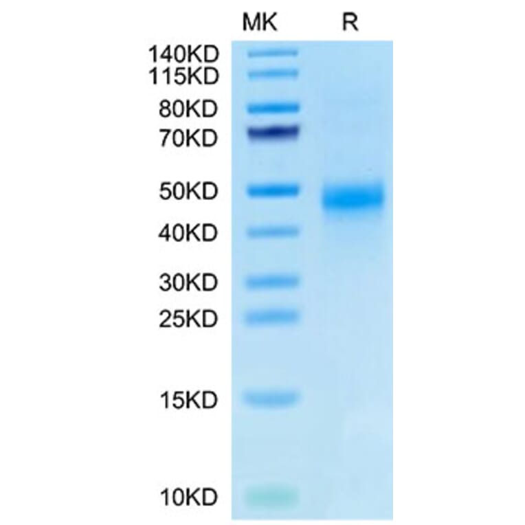 Tris-Bis PAGE - Recombinant Human CTGF Protein (Biotin) (C-terminal His and Avi Tag) (A331540) - Antibodies.com