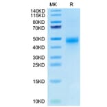Tris-Bis PAGE - Recombinant Human CTGF Protein (Biotin) (C-terminal His and Avi Tag) (A331540) - Antibodies.com